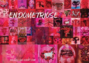 endométriose-celles-qui-osent-CQO