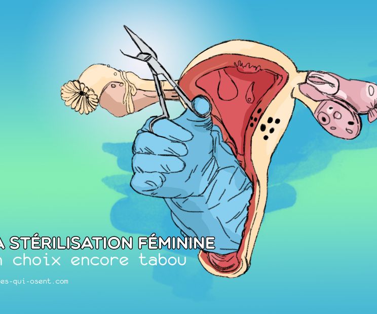 sterilisation-femme